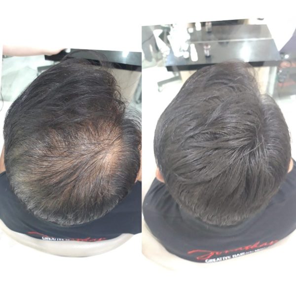 PAKET SMH Hair Mist 60 ml + 2 Mini Hair Fiber Black - Image 4