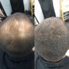 SMH Million Hair Fiber Black 10gr - Image 3
