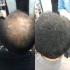 SMH Million Hair Trial Set DARK BROWN - Image 2