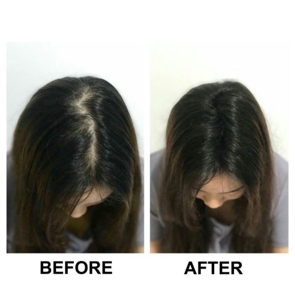 SMH Million Hair Trial Set DARK BROWN - Image 3