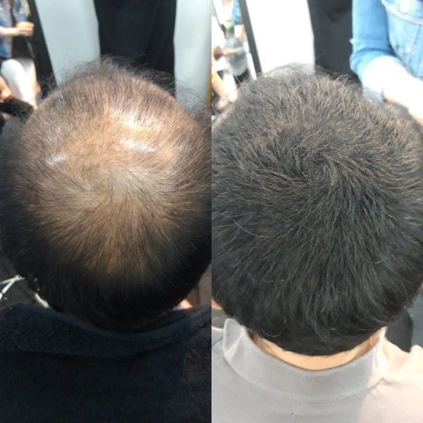 SMH Million Hair Trialset Light Brown - Image 3